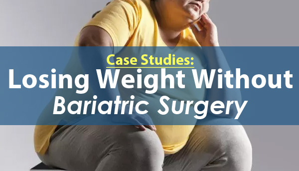 Losing Weight Without Bariatric Surgery